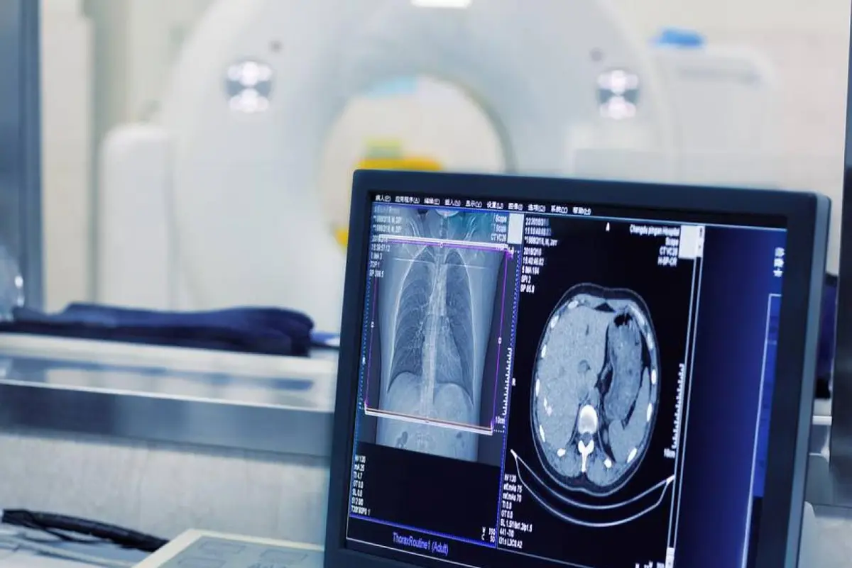Radiologia Musculoesquelética na Clinoson