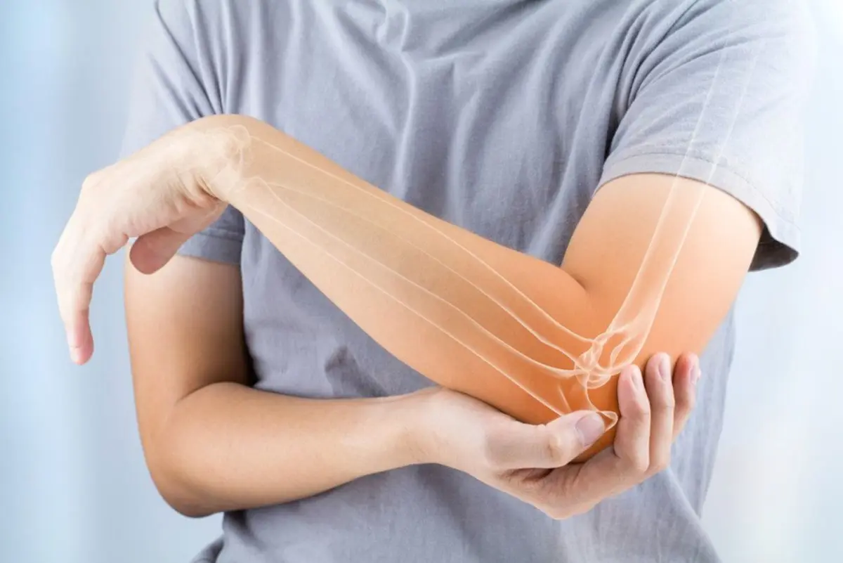Osteoporose e Doenças Metabólicas na Clinoson