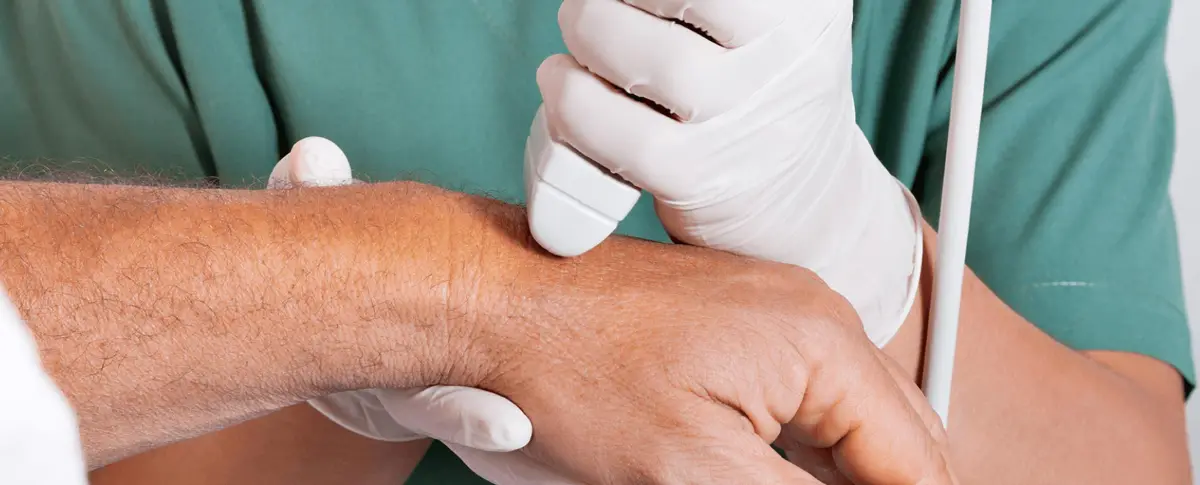 Ecodoppler Vascular na Clinoson, em Porto Alegre