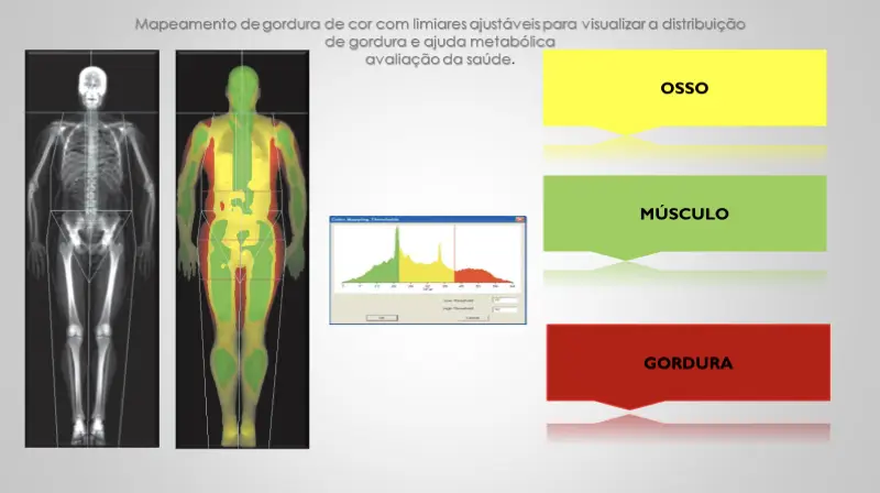 Avaliação da Composição Corporal (DXA) – Clinoson
